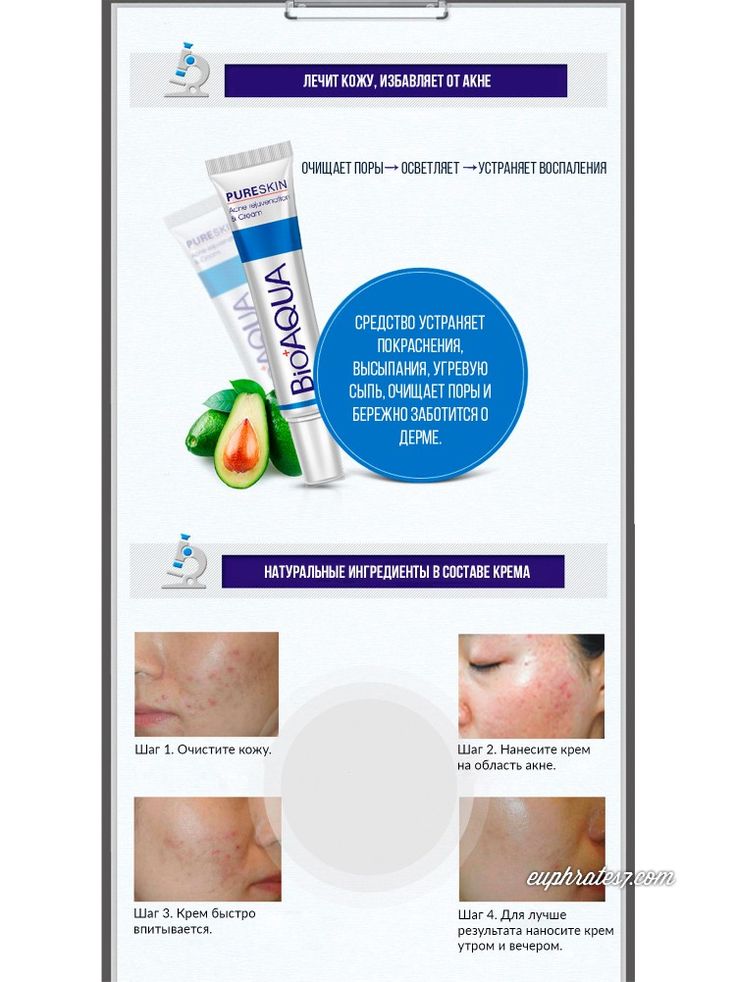 BioAqua Acne & Scar Removal Cream – 30g